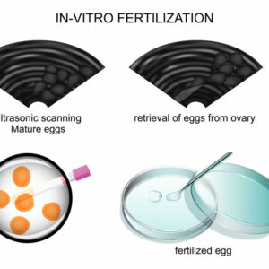 Medicación previa a la fecundación in vitro