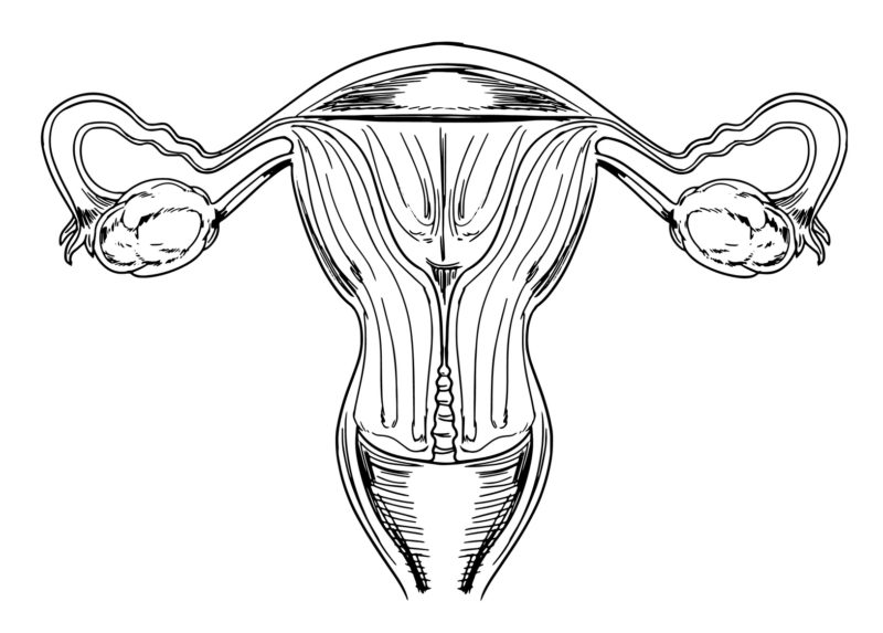 Mioma uterino Mioma uterino