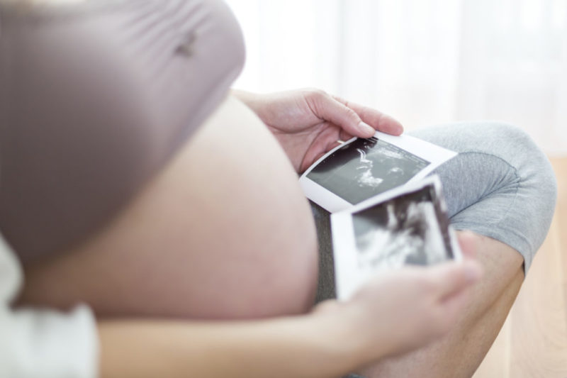 Mujer asegura que tendría gemelos