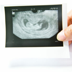 Nace en Sevilla otro 'bebé medicamento'