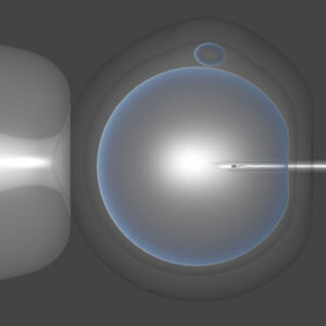 Nociones sobre la Esterilidad, su diagnóstico y tratamiento