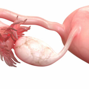 Nuevas aportaciones del Instituto Bernabeu en el avance del perfil genético de la paciente con Baja reserva ovárica