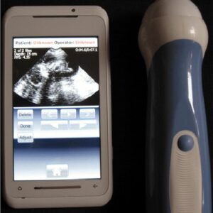 Nuevo ecógrafo para tu Smartphone