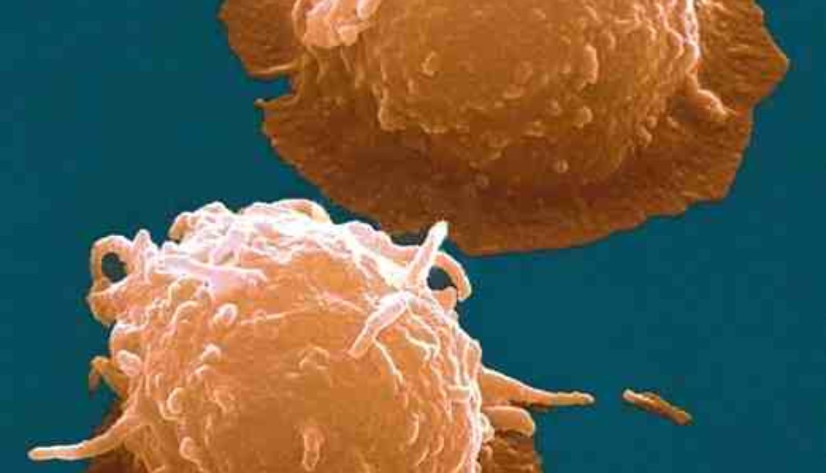 Nuevo ensayo clínico en marcha para el tratamiento de la artrosis usando células madre