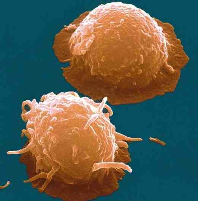 Nuevo ensayo clínico en marcha para el tratamiento de la artrosis usando células madre