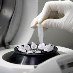 Ojo con comprar esperma por internet