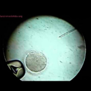 Proceso de Microinyección espermática o ICSI