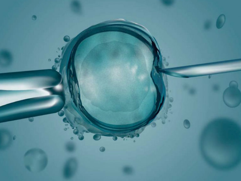 Muchos Gases Después De La Punción Ovárica Punción ovárica: Qué es, para qué sirve, riesgos y resultados