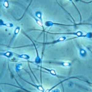 Relacionan la baja calidad del esperma al consumo de grasas