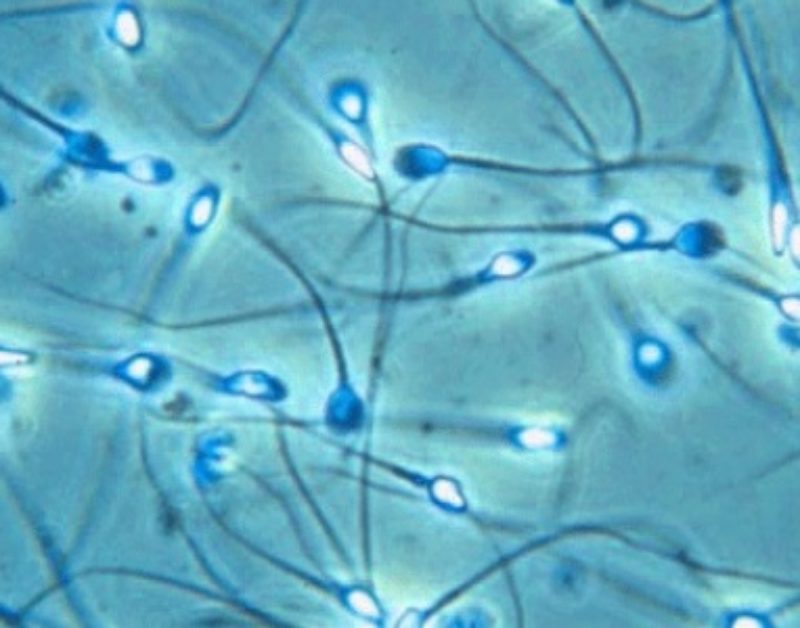 Relacionan la baja calidad del esperma al consumo de grasas