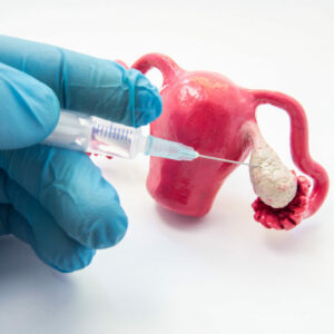 Riesgos y complicaciones de la reproducción asistida