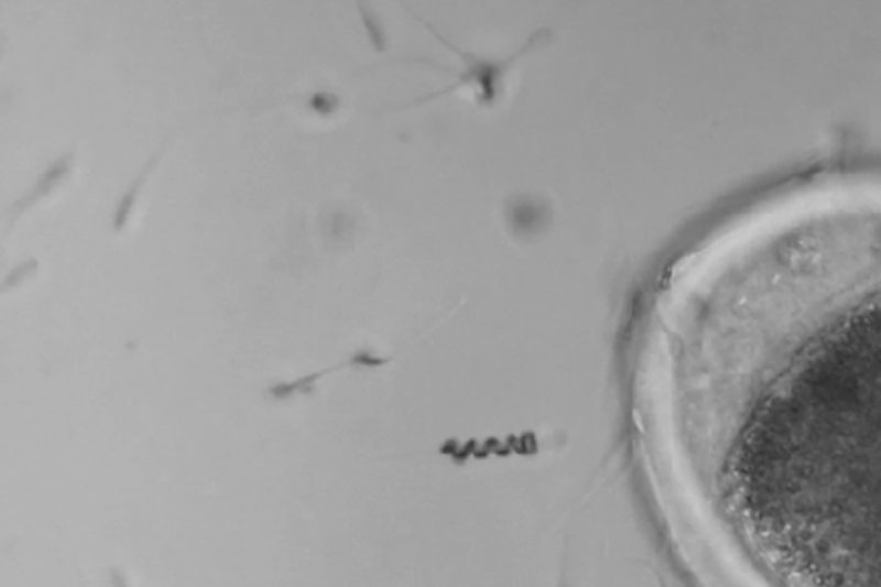 Robots contra la infertilidad