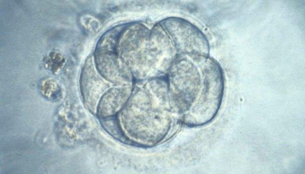 Transferencia embrionaria en día 4, ¿por qué no?