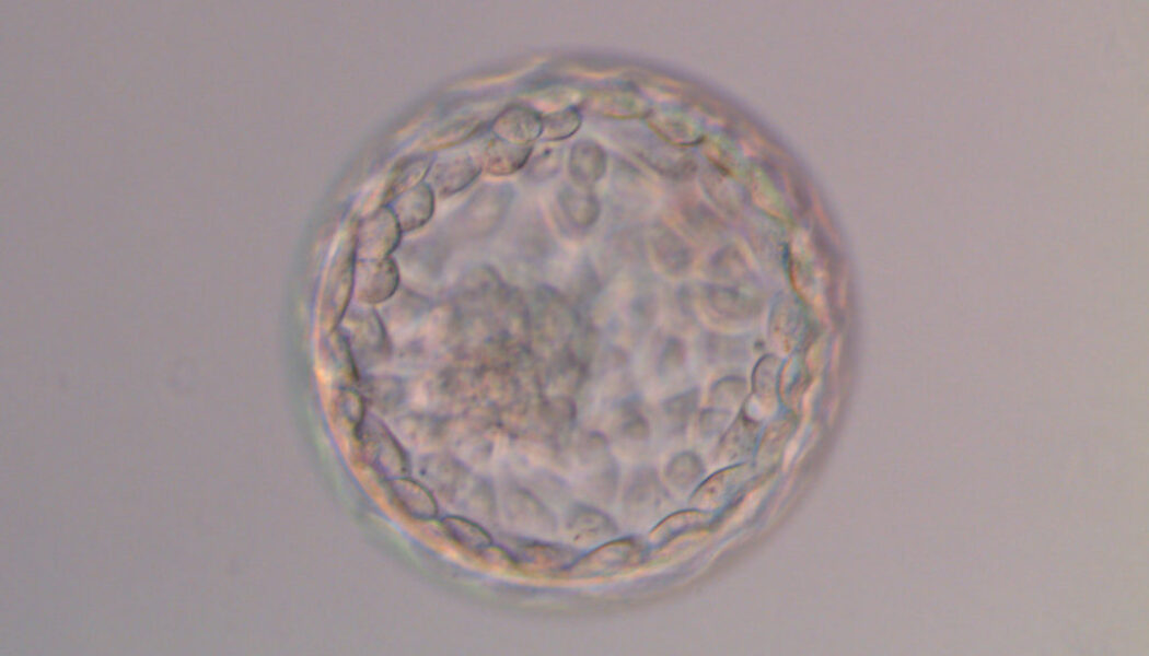 Transferir dos embriones, posible causa de fracaso en algunos casos de FIV, según un estudio