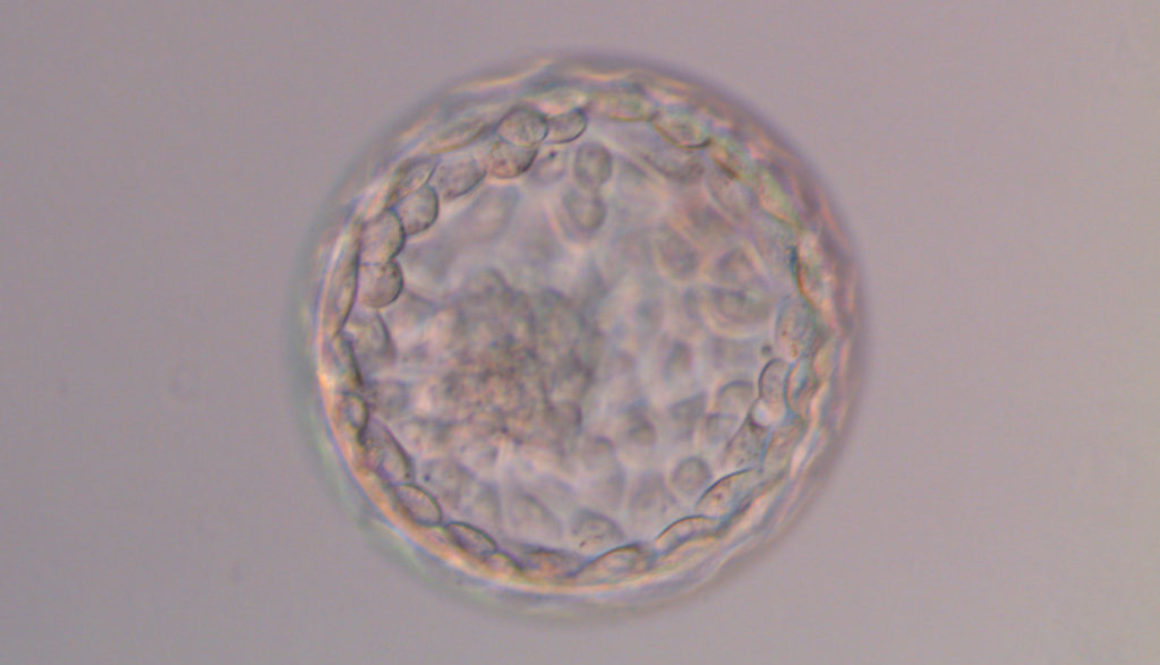 Transferir dos embriones