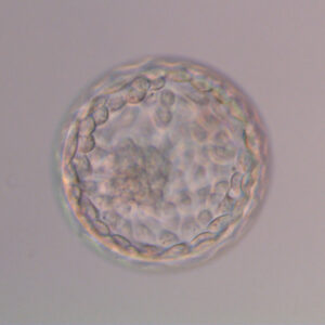 Transferir dos embriones, posible causa de fracaso en algunos casos de FIV, según un estudio