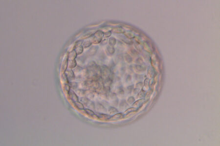 Transferir dos embriones, posible causa de fracaso en algunos casos de FIV, según un estudio