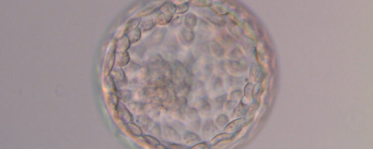 Transferir dos embriones, posible causa de fracaso en algunos casos de FIV, según un estudio