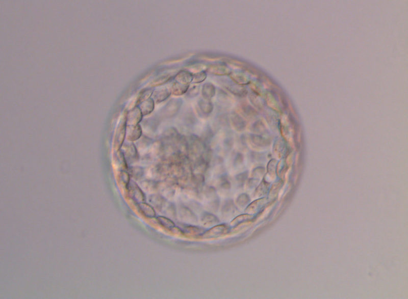 Transferir dos embriones