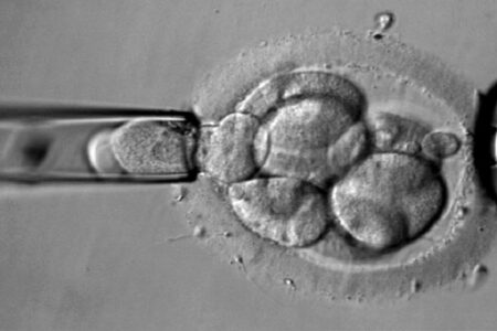 Transferir embriones cromosómicamente “anormales” puede resultar en un embarazo saludable