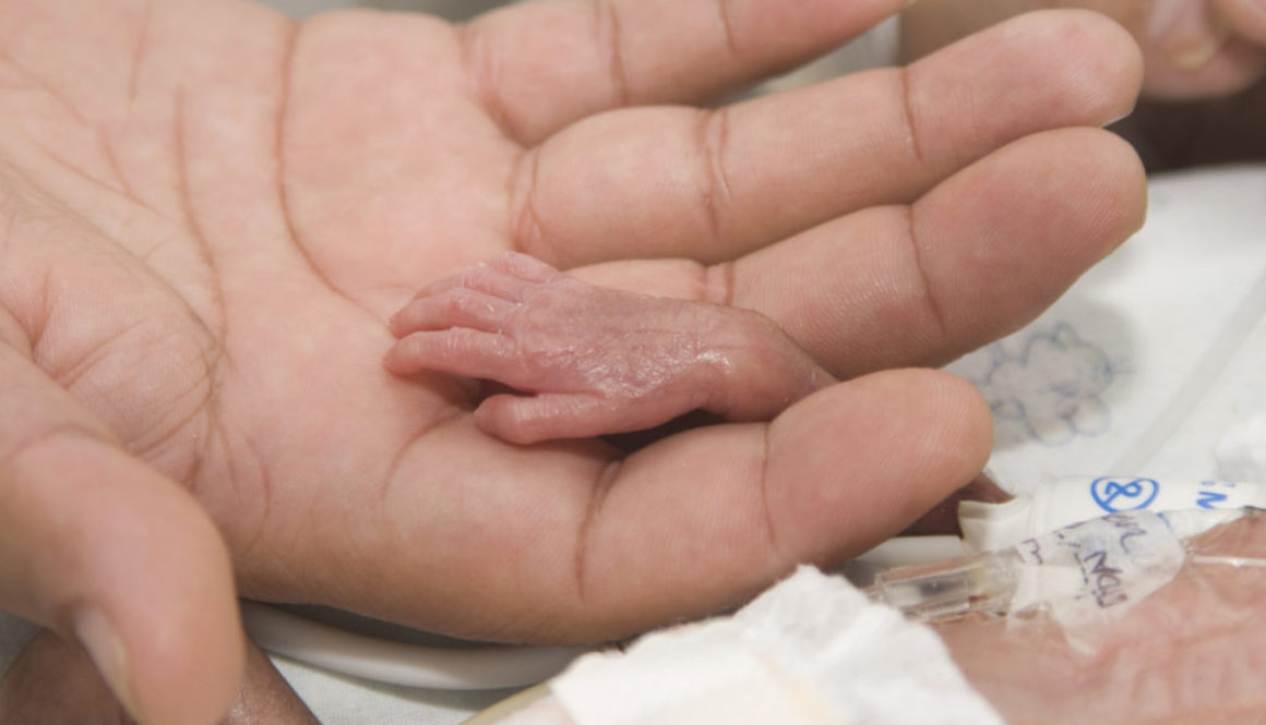 Triste final para dos de los Quintillizos procreados por Inseminación Artificial