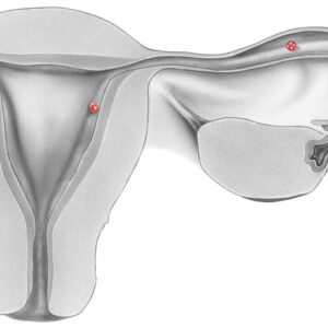 UNIDAD DE ABORTO DE REPETICIÓN y FALLO DE IMPLANTACIÓN