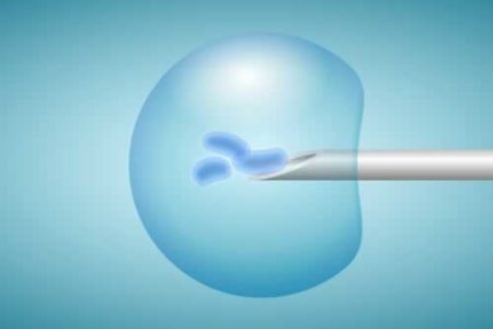 Un centenar de orensanas se desplazan cada año a Vigo