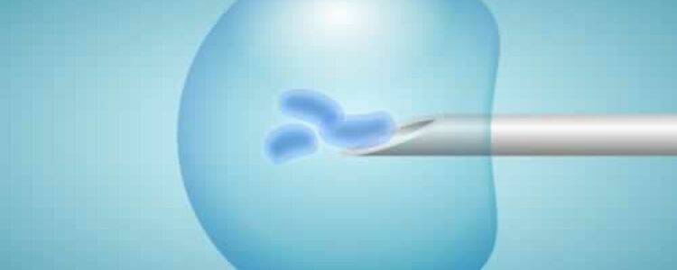 Un centenar de orensanas se desplazan cada año a Vigo