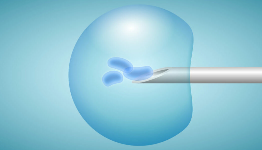 Un estudio demuestra que utilizar un solo embrión en la ” fecundación in vitro ” no reduce la tasa de emabarazos