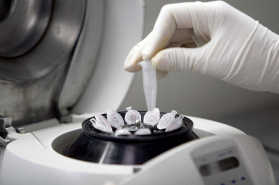 Un hospital de Utrecht investiga la posible inseminación errónea de 26 mujeres