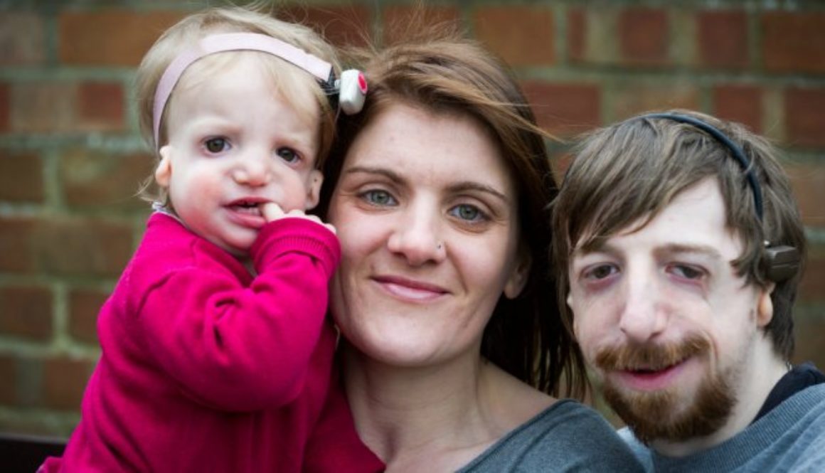 Una pareja decidió tener un bebé por reproducción asistida sin evitar la enfermedad genética del padre