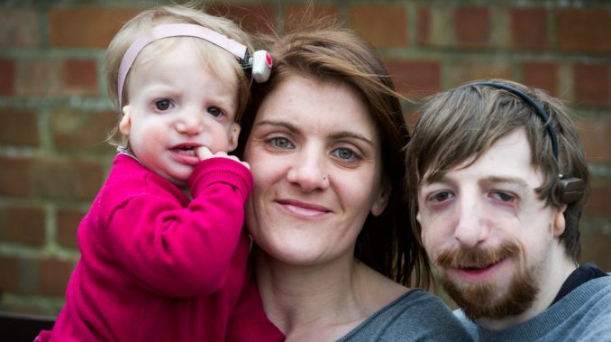Una pareja decidió tener un bebé por reproducción asistida sin evitar la enfermedad genética del padre