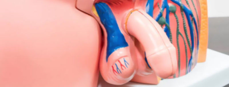 Varicocele e infertilidad masculina