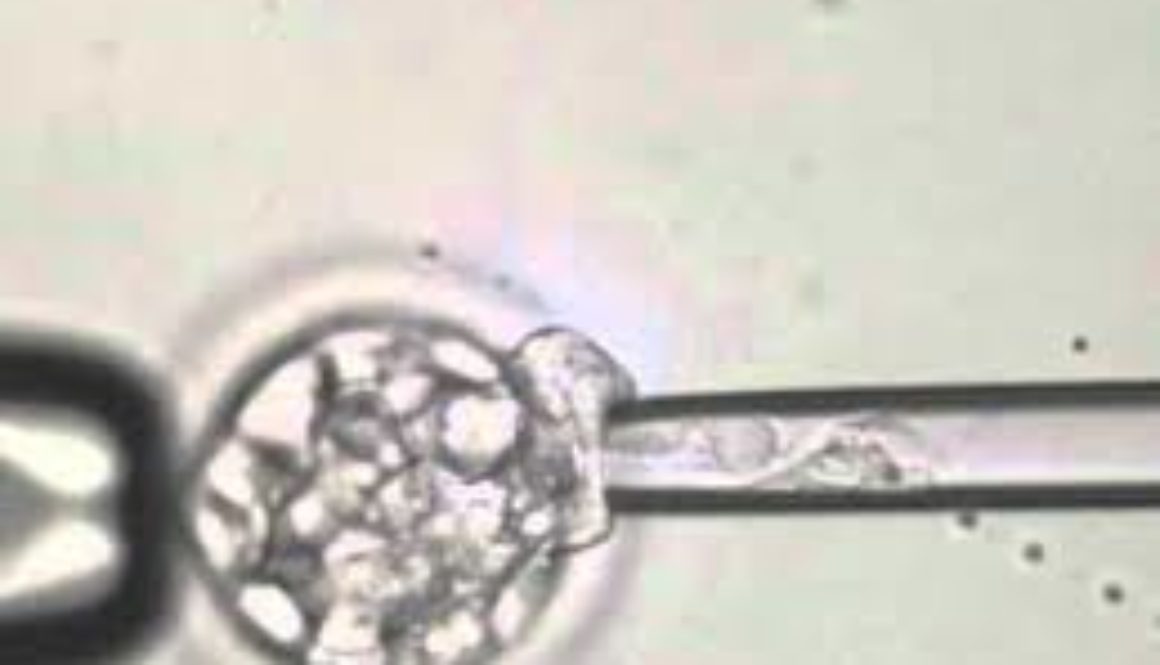 SEGUNDA FIV CON 41 AÑOS