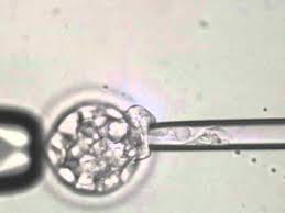 SEGUNDA FIV CON 41 AÑOS