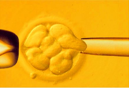 ¿Con 38 años es más difícil que funcione la Fecundación in vitro?