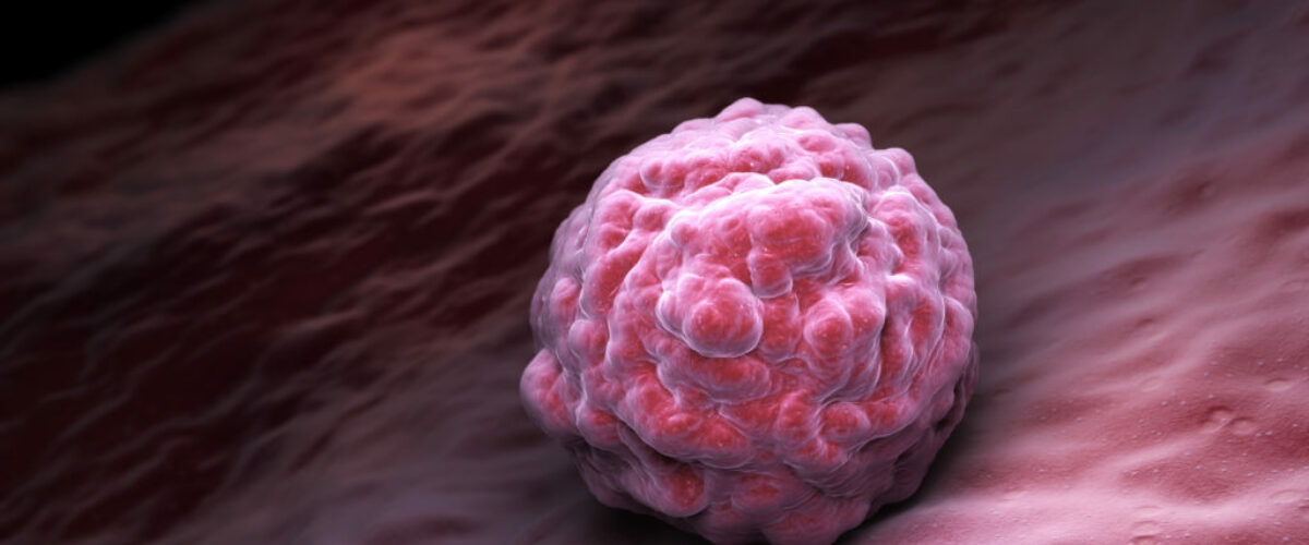 ¿Qué es la ovulación múltiple? ¿Qué es la ovulación múltiple?