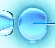 Inseminación Invitro