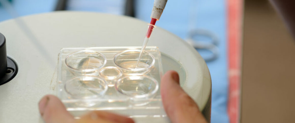 A vet picks up calf embryos for implantation into surrogate cows in an artificial breeding program A vet picks up calf embryos for implantation into surrogate cows in an artificial breeding program