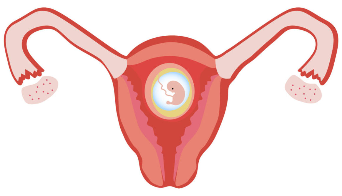 ¿Qué medicación tomas para preparar el endométrio?