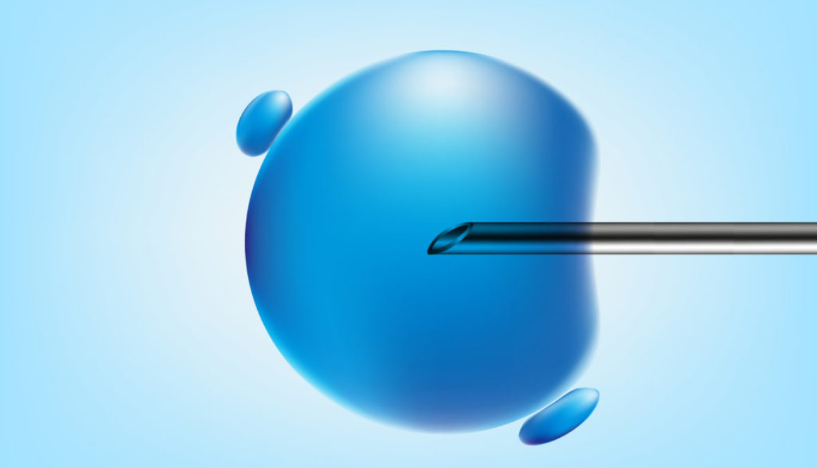 ¿Cuales son los factores para conseguir un embarazo tras una Fecundación in vitro?