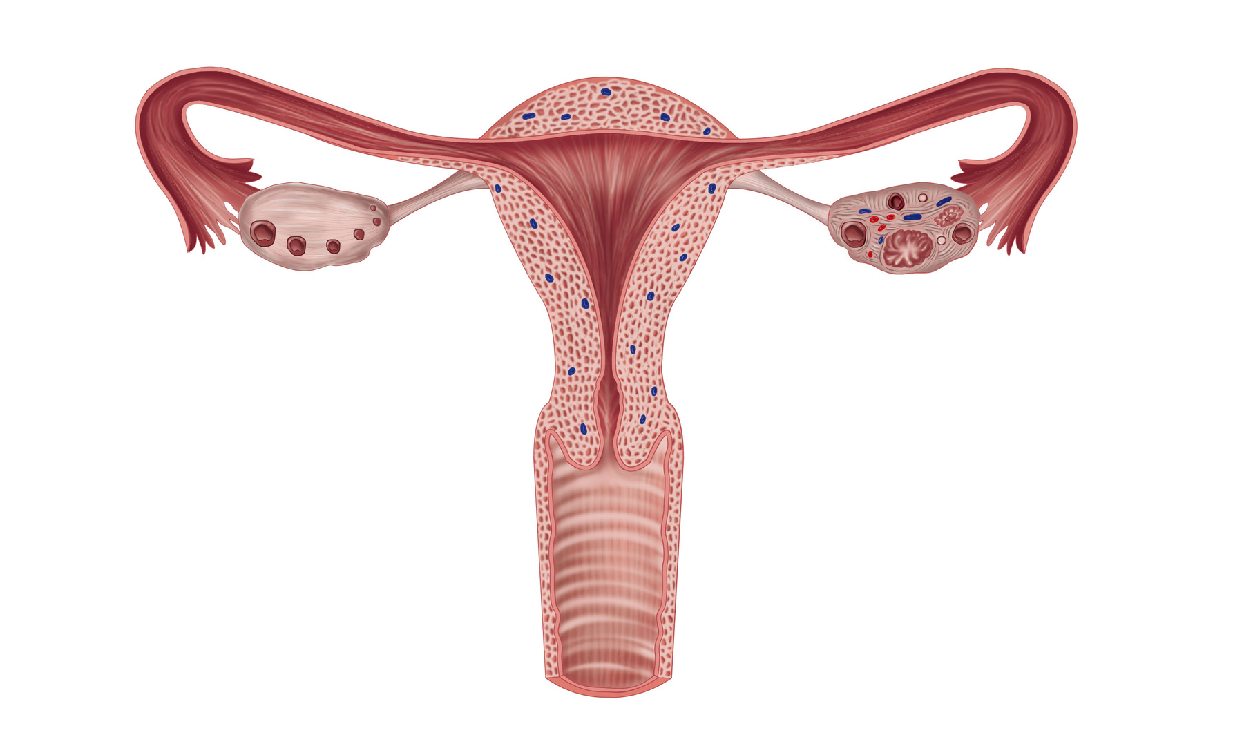 ¿Podría ser del folículo?