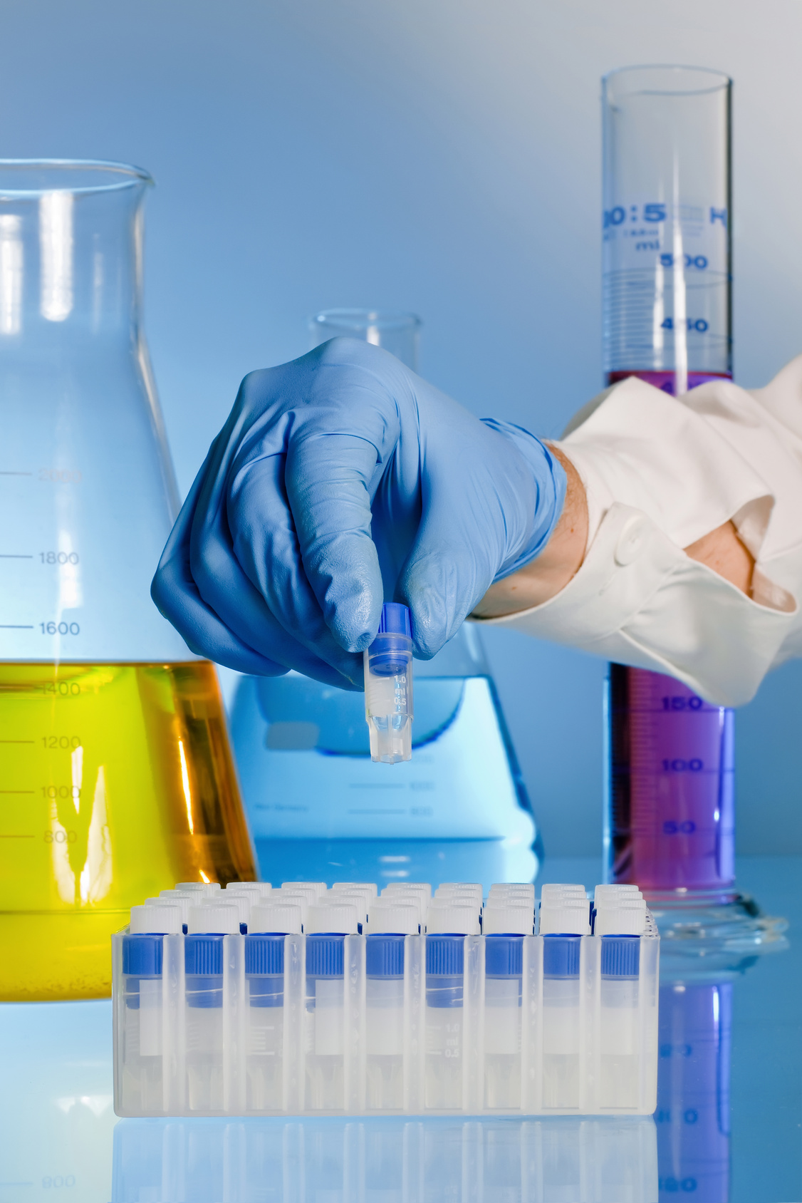 ¿Por qué esa diferencia de FSH en dos meses?