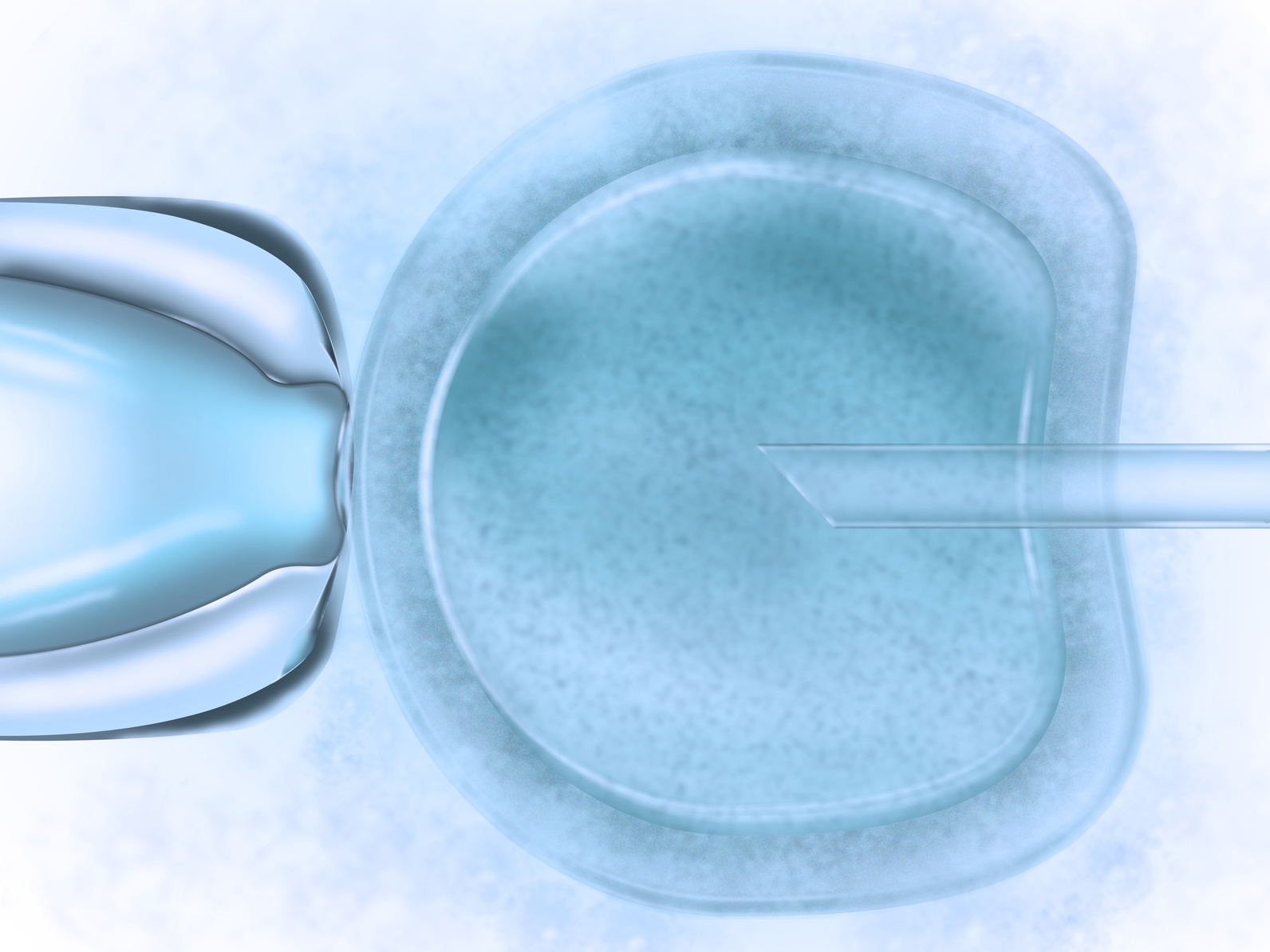 Knstliche Befruchtung - In-Vitro-Fertilisation