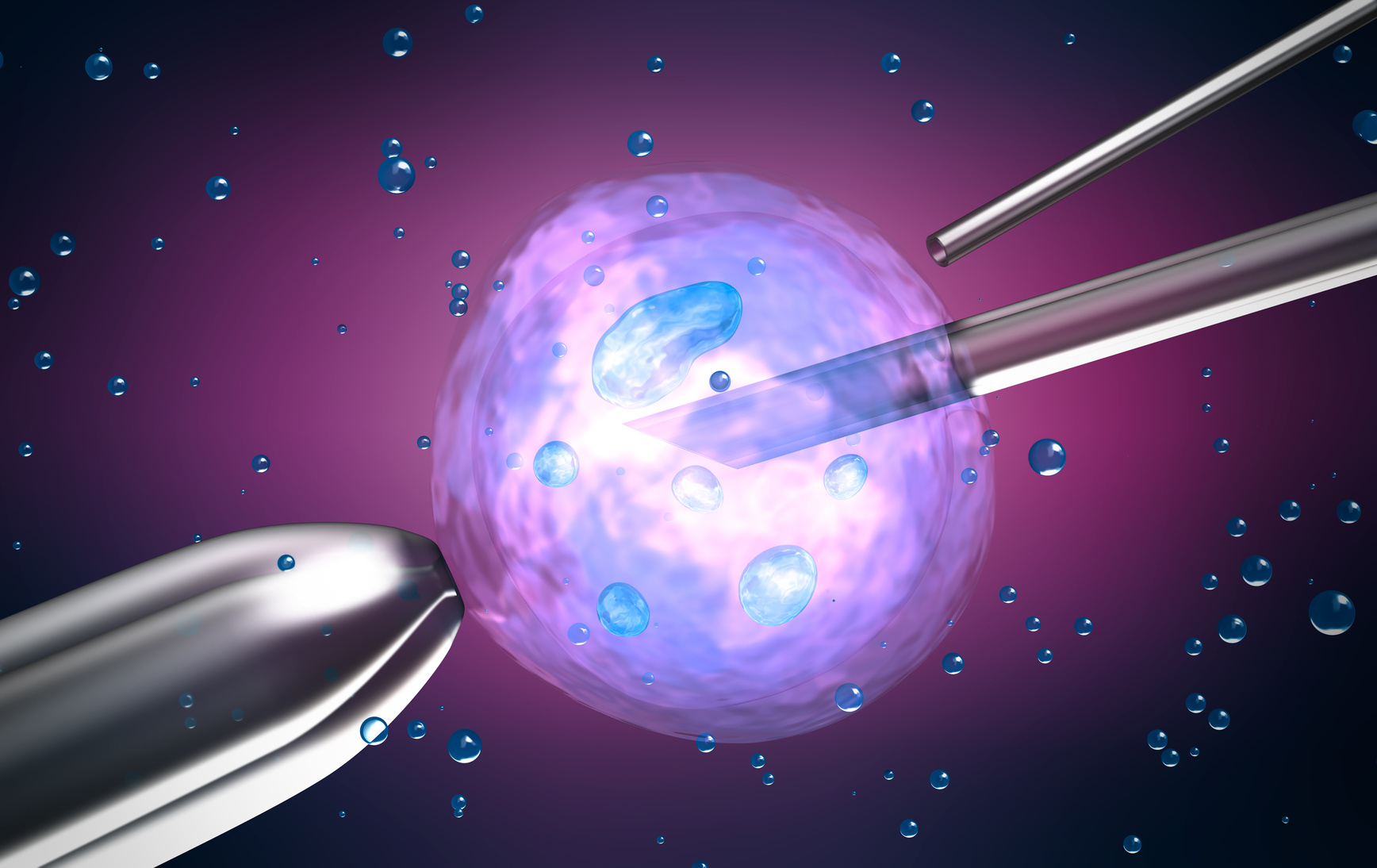 ¿Me recomienda pasar directamente a la Fecundación in Vitro?