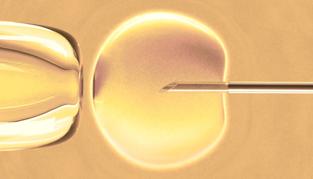 In vitro fecundation using sperm (warm color) In vitro fecundation using sperm (warm color)