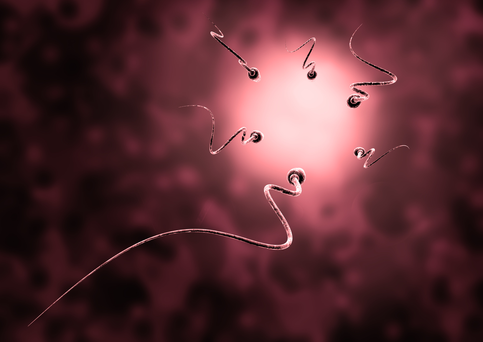 ¿Es normal el resultado de esta espermiograma ?