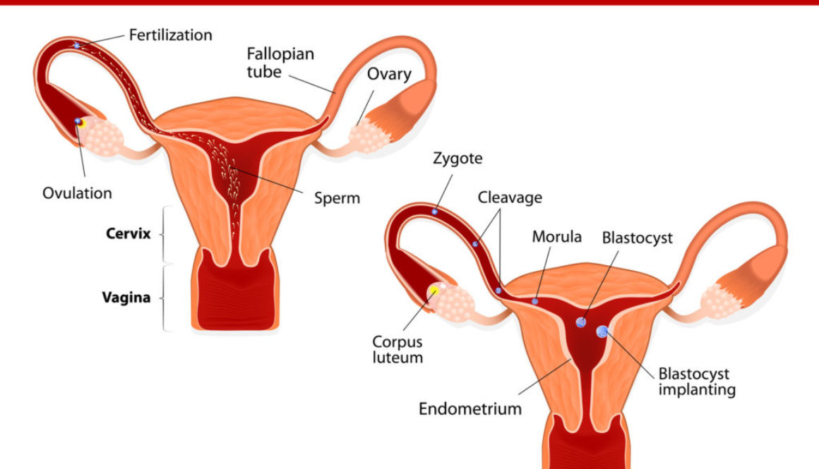 ¿Esto significa que tengo endometriosis?