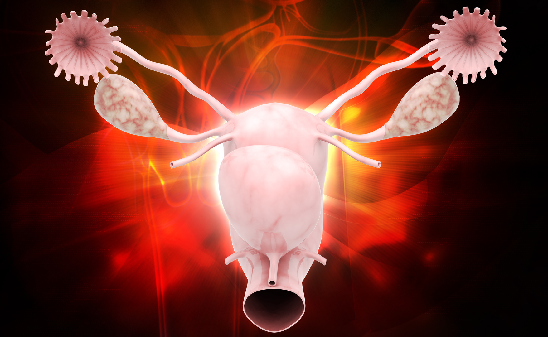¿Mi única opción es la Fecundación In Vitro ?