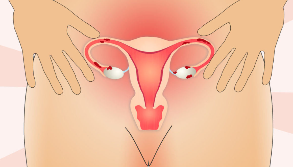 ¿Después de dos años?